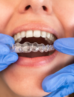 Best Implantologist in Ranchi