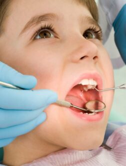 Root Canal Specialist in Ranchi